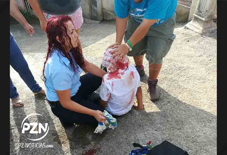 Escolar resultó herido al caer con su bicicleta en un enorme hueco en Pérez Zeledón