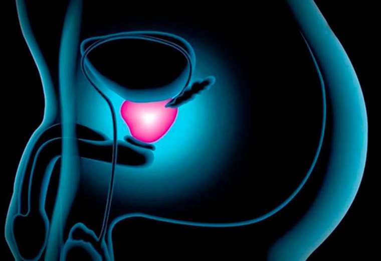Tratamientos para problemas de la próstata y cáncer testicular