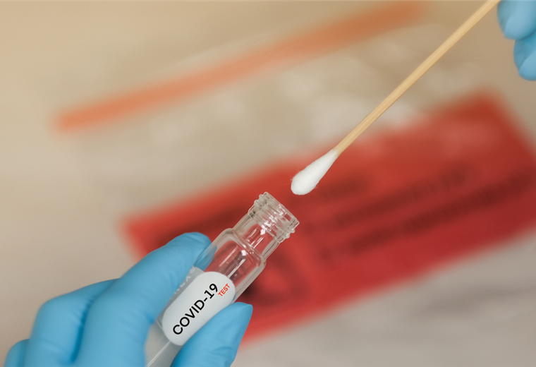 Contraloría señala debilidades y descontrol en registro de pruebas COVID-19