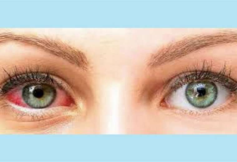 Todos los tratamientos que debe conocer para evitar un ojo seco