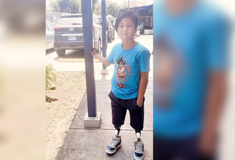 Entrevista con Andy Avellán, niño que perdió las piernas por enfermedad congénita