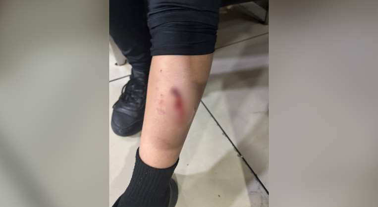 Madre denuncia mordedura de perro a su hijo