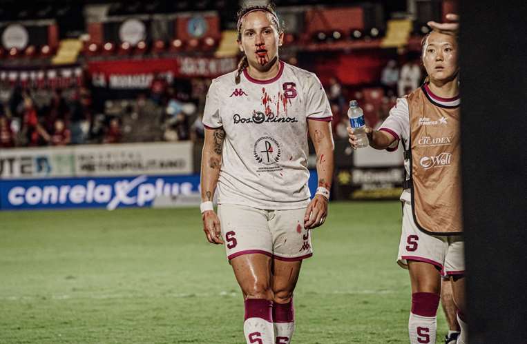 Alajuelense vs. Saprissa. Foto: Prensa Saprissa