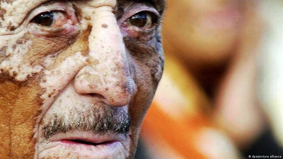 La trágica huella de los pesticidas en América Latina - Imagen de la noticia