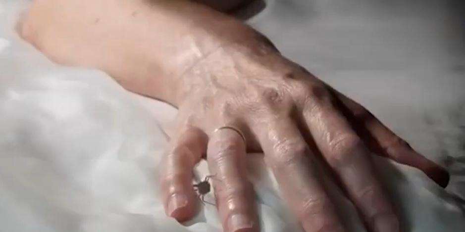 Enfermedades “olvidadas” resurgen y elevan riesgo en Costa Rica, advierte UNA - Imagen de la noticia