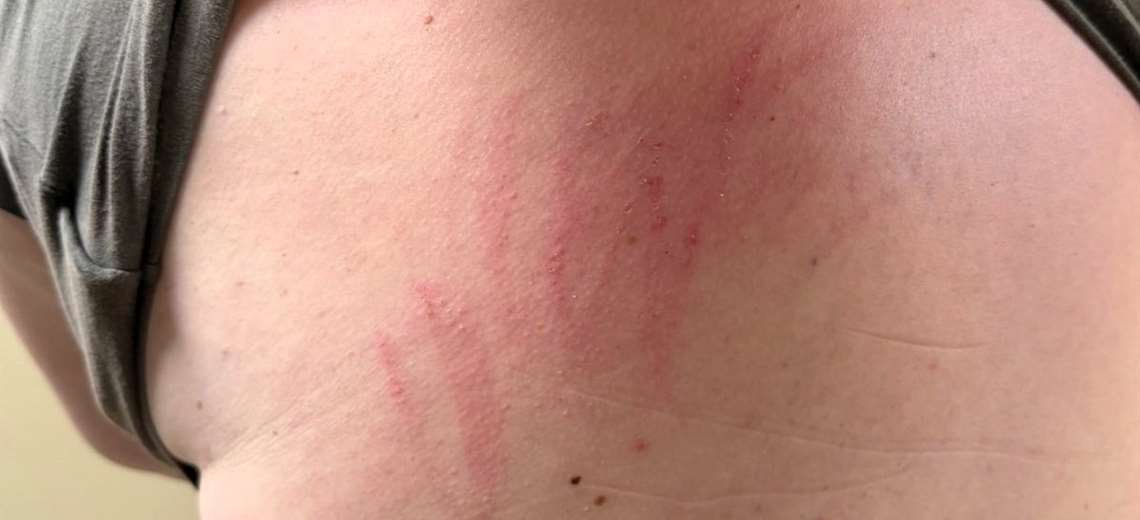 Video: Denuncian a enfermera por supuesta agresión en clínica de San José