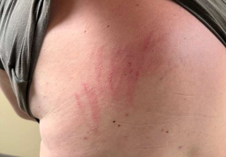 Agresión en clínica