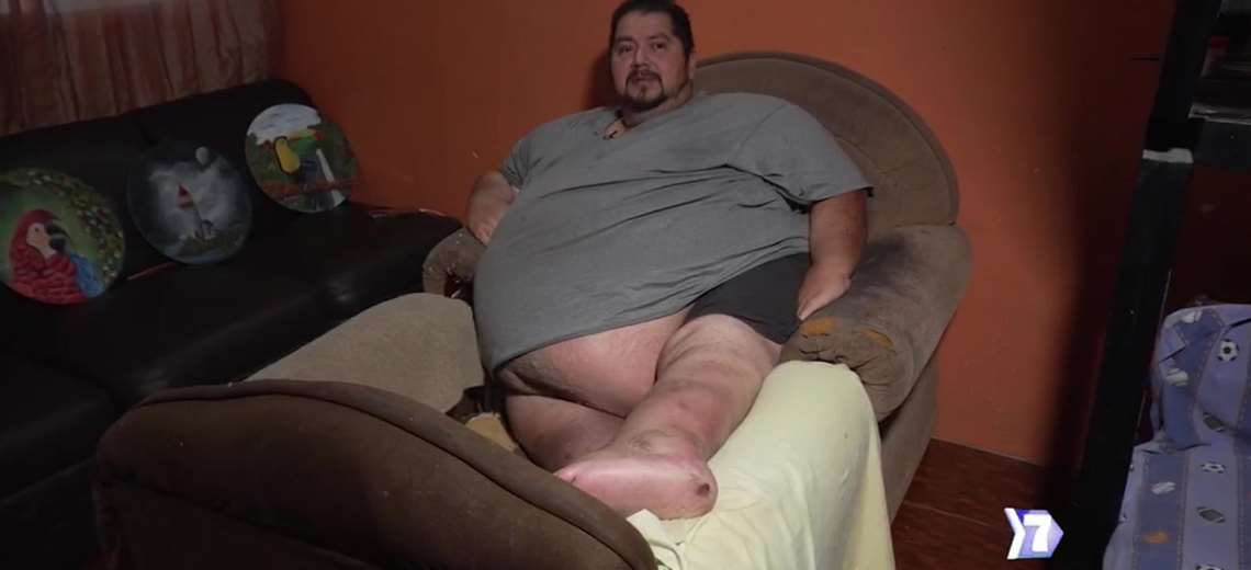 Sobrepeso: ¿un asunto de Estado?