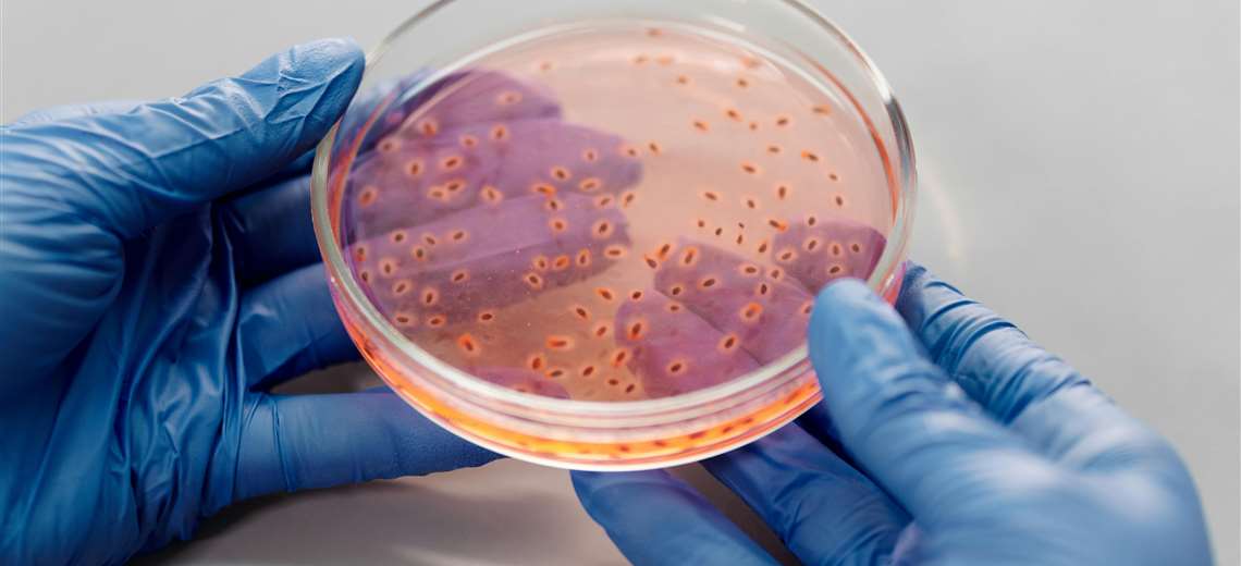¿Qué es la salmonella? Estas son las formas de contagio y cómo prevenirla