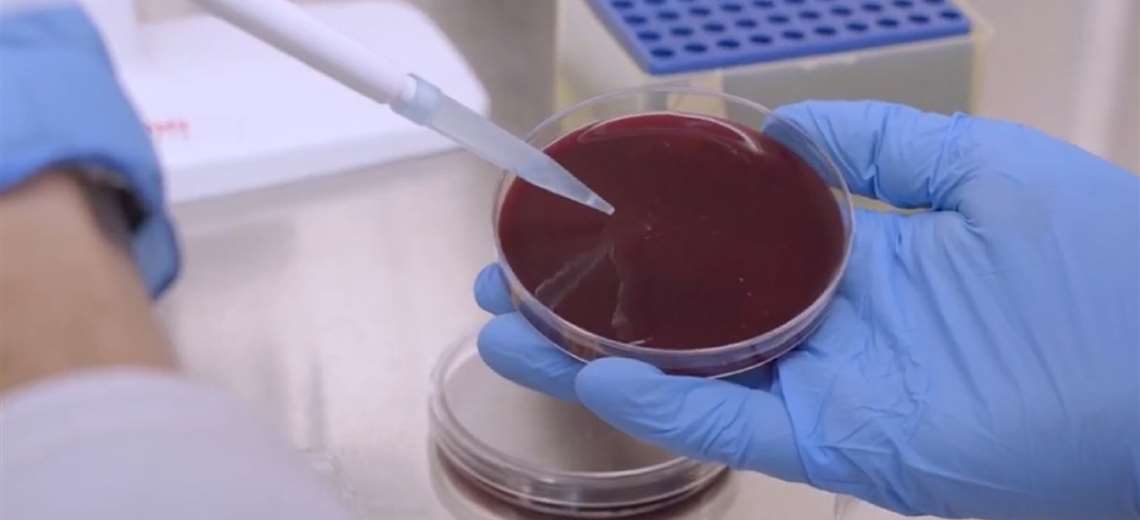 Vecina de Ciudad Colón cuenta lo que vivió tras contagiarse de Salmonella
