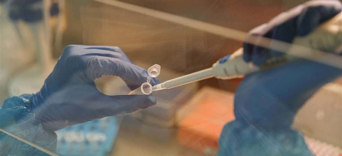 Detectan inusual parásito en Costa Rica: ¿Qué es la leishmaniasis y cómo se transmite?