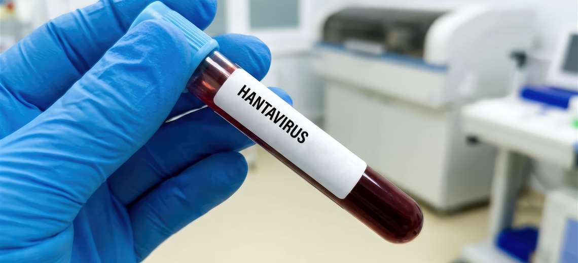 OMS confirma cinco casos de hantavirus